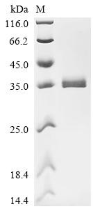 Ubiquitin-conjugating enzyme E2 J1 (UBE2J1), partial, recombinant human