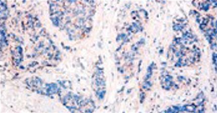 Anti-Tetherin / CD317