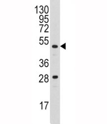 Anti-Urokinase