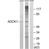 Anti-ADCK1