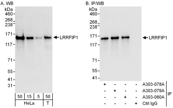 Anti-LRRFIP1