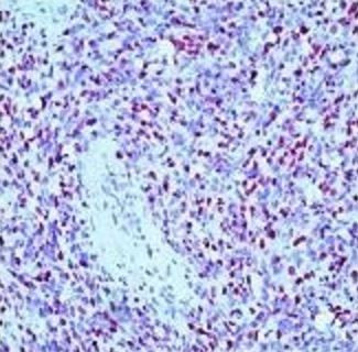 Anti-Myogenin, clone F12B