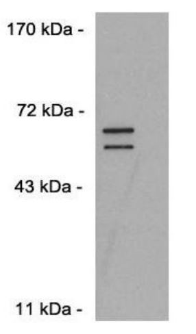 Anti-DUX4, clone P4H2