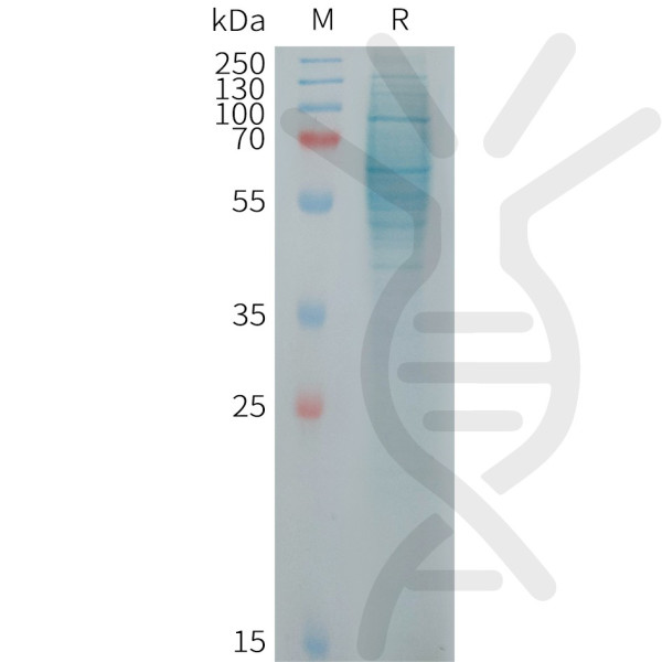 Human IL23R Protein, His Tag