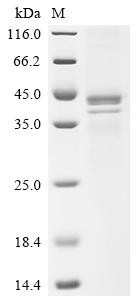 Guanine nucleotide-binding protein G(i) subunit alpha-1 (GNAI1), human, recombinant