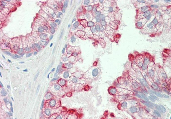 Anti-HRH3 / Histamine H3 Receptor