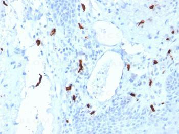 Anti-Tryptase (Mast Cell Marker) Monoclonal Antibody (Clone: TPSAB1/1961)
