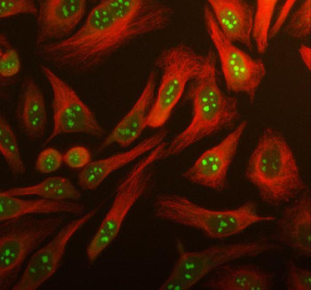 Anti-ARL3 / ADP-ribosylation factor-like protein 3