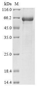 Alanine aminotransferase 2 (GPT2), human, recombinant