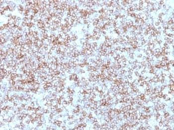 Anti-HLA-DP + HLA-DR (MHC II), clone Bra-14