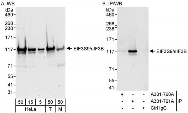 Anti-eIF3B/EIF3S9