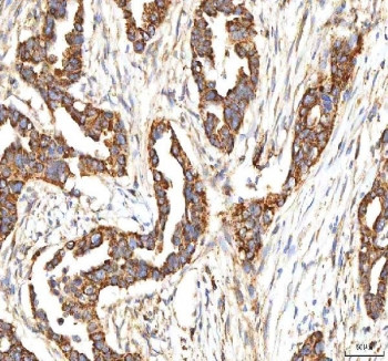 Anti-ITPA / Inosine triphosphate pyrophosphatase / ITPase