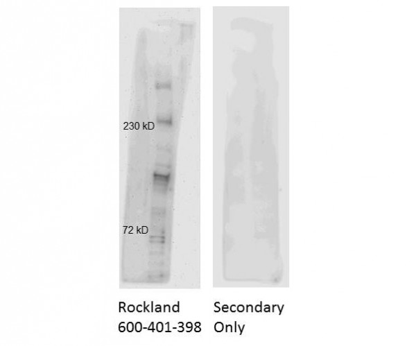 Anti-ATM Protein Kinase