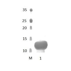 InaDl_6 PDZ Domain