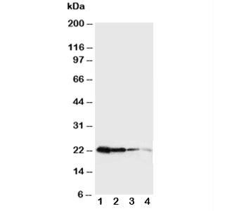 Anti-Growth Hormone (Mouse)