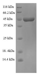 Super small secreted glycoprotein (GP), Zaire ebolavirus, recombinant