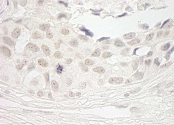 Anti-PPP1CB (IHC)