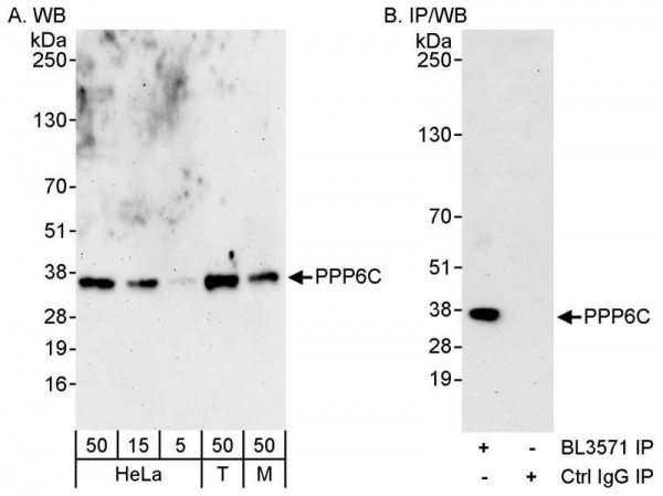 Anti-PPP6C