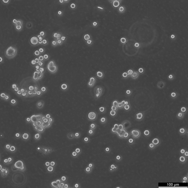 ZR-75-30 Cells