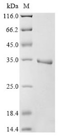 Egl nine homolog 1 (EGLN1), partial, human, recombinant