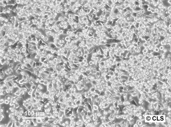 CERV-186 Cells