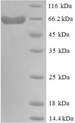 Delta-like protein 3 (DLL3), partial, human, recombinant