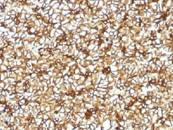 Anti-SPTBN2 / Spectrin beta III, clone SPTBN2/1582
