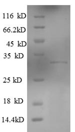 Killer cell lectin-like receptor subfamily G member 1 (KLRG1), partial, human, recombinant