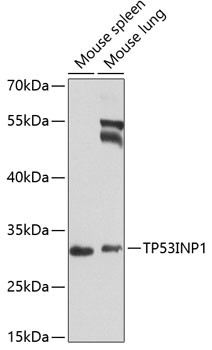 Anti-TP53INP1
