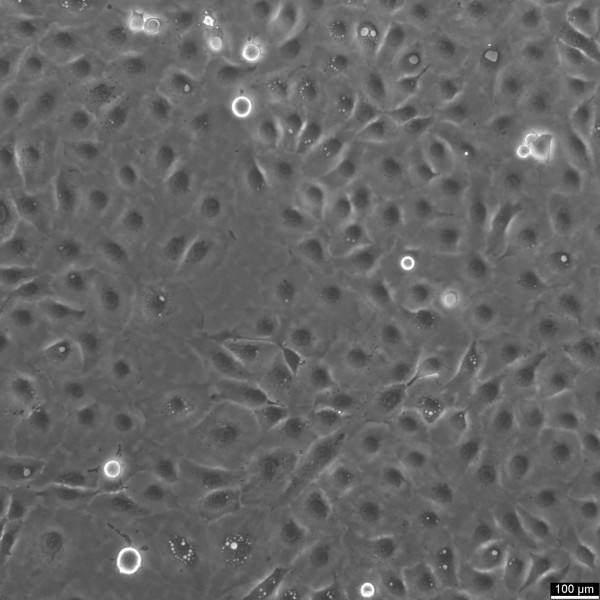 NCI-H1650 Cells