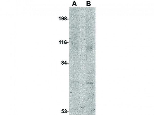 Anti-JPH1