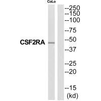 Anti-CSF2RA