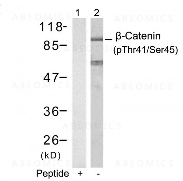 Anti-phospho-beta-Catenin (Thr41/Ser45)