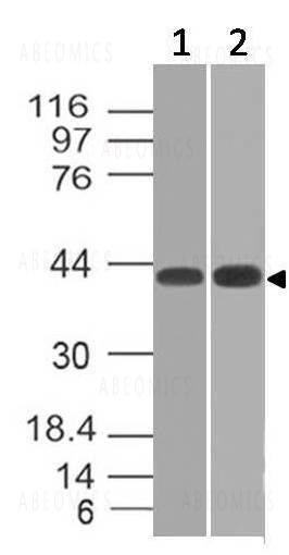 Anti-TSLP Receptor (Clone: ABM2D87)