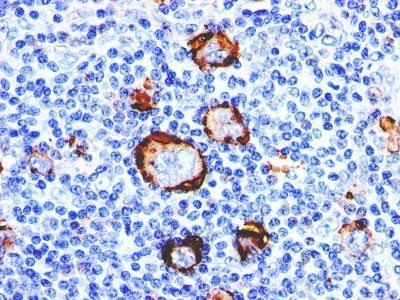 Anti-CD15 / FUT4 / Lewis x(MMA (Leu-M1)), 1mg/mL