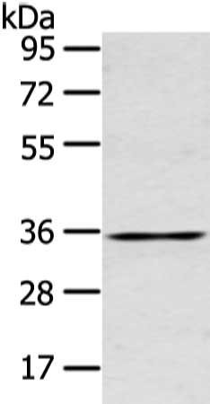 Anti-GJB5