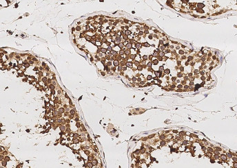 Anti-RUVBL1/RVB1 Monoclonal Antibody