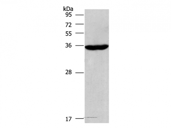 Anti-CIAPIN1