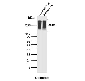 Anti-P Glycoprotein / MDR1 / ABCB1, clone ABCB1/9309