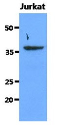 Anti-Sorbitol Dehydrogenase, clone 10F4