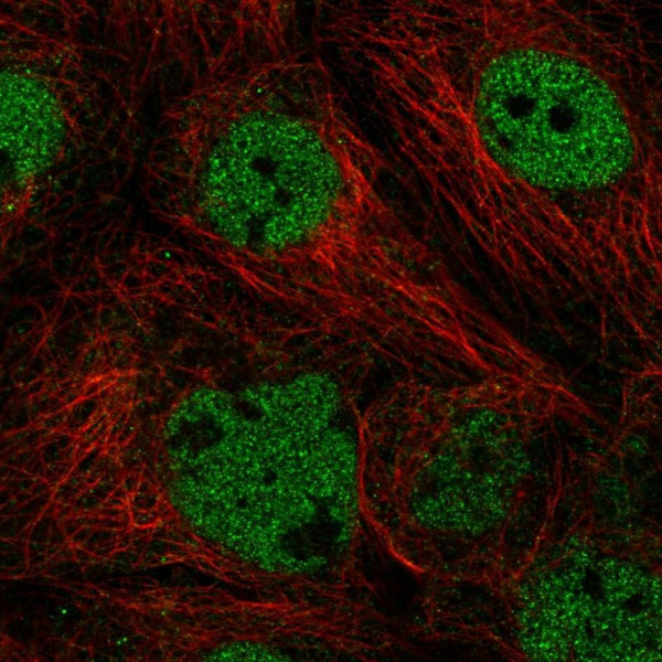 Anti-ACTL6A