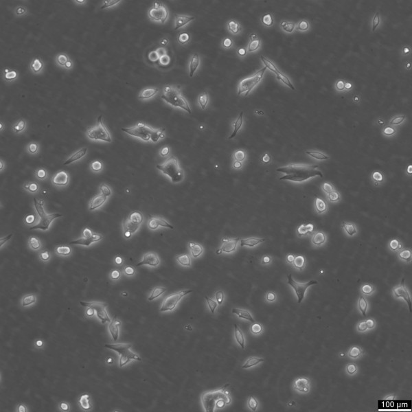 TT Cells