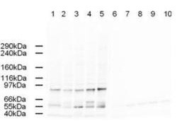 Anti-AP2A1 (alpha 1 subunit of adaptor-related protein complex 2)