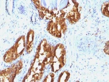 Anti-Prostate Specific Acid Phosphatase (PSAP) Monoclonal Antibody (Clone: ACPP/1338)