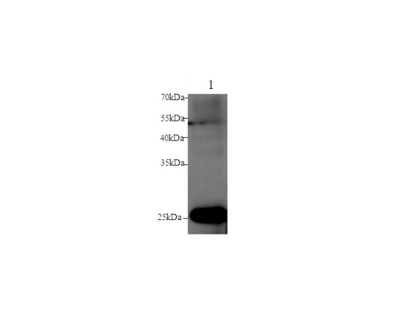 Anti-GSTM1