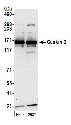 Anti-Caskin 2