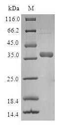 Mitochondrial import inner membrane translocase subunit Tim8 A (TIMM8A), human, recombinant
