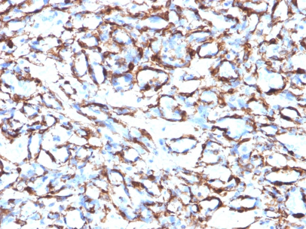 Anti-Actin, Smooth Muscle (Leiomyosarcoma Marker), clone ACTA2/791