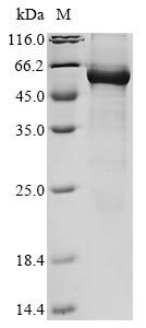 Bifunctional 3'-5' exonuclease/ATP-dependent helicase WRN (WRN), partial, human, recombinant