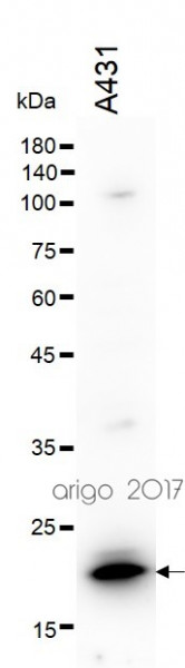 Anti-Proteasome 20S LMP2